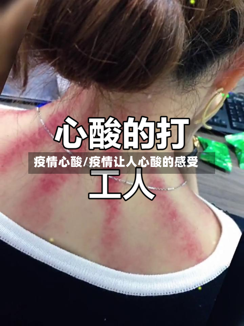 疫情心酸/疫情让人心酸的感受