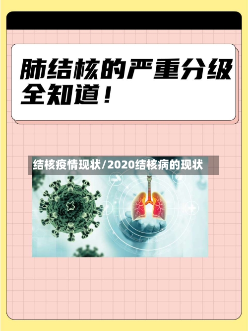 结核疫情现状/2020结核病的现状