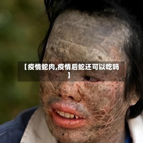 【疫情蛇肉,疫情后蛇还可以吃吗】