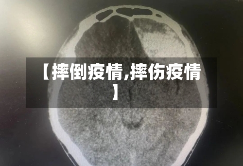 【摔倒疫情,摔伤疫情】